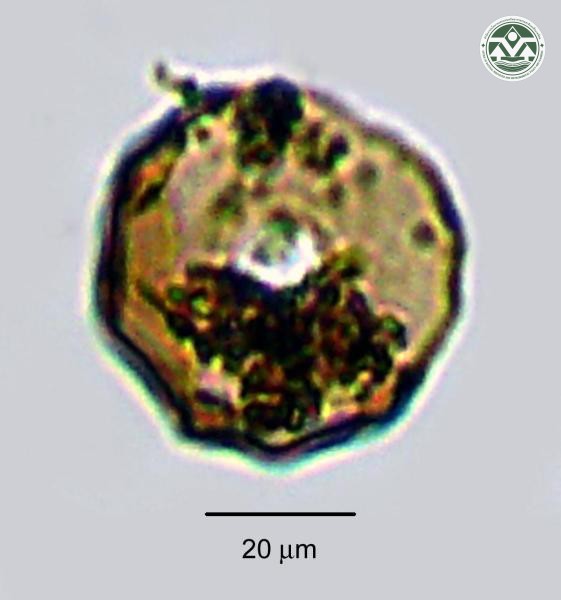 Arcella gibbosa