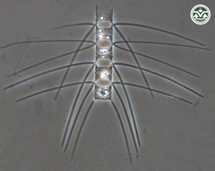 Chaetoceros lorenzianus