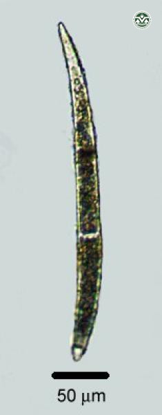Closterium praelongum