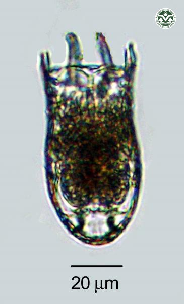 Keratella cochlearis
