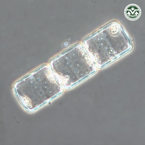 Lauderia annulata