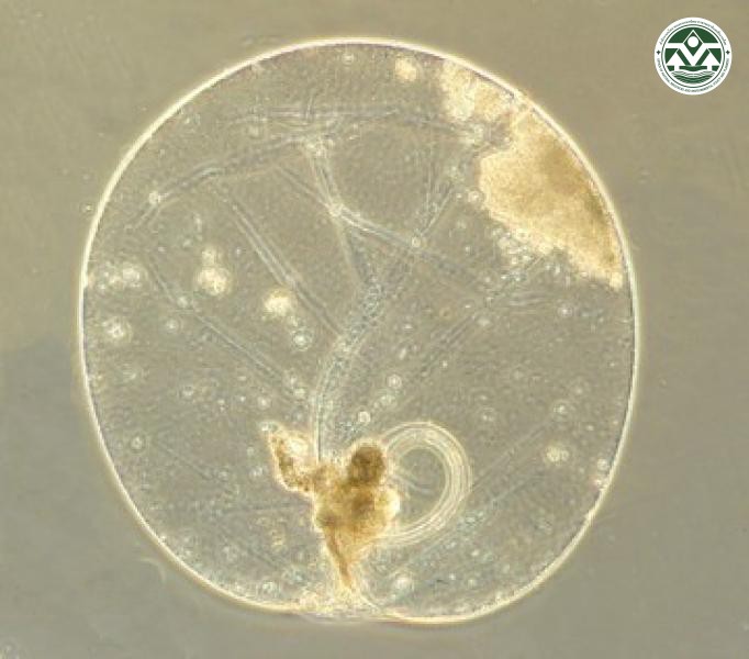 Noctiluca scintillans