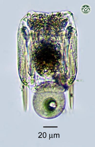 Polyarthra vulgaris