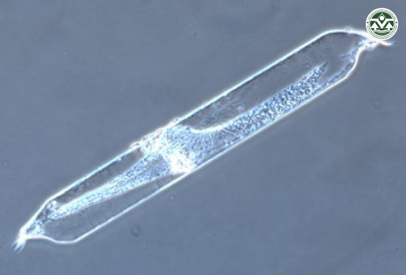 Pseudosolenia calcar-avis