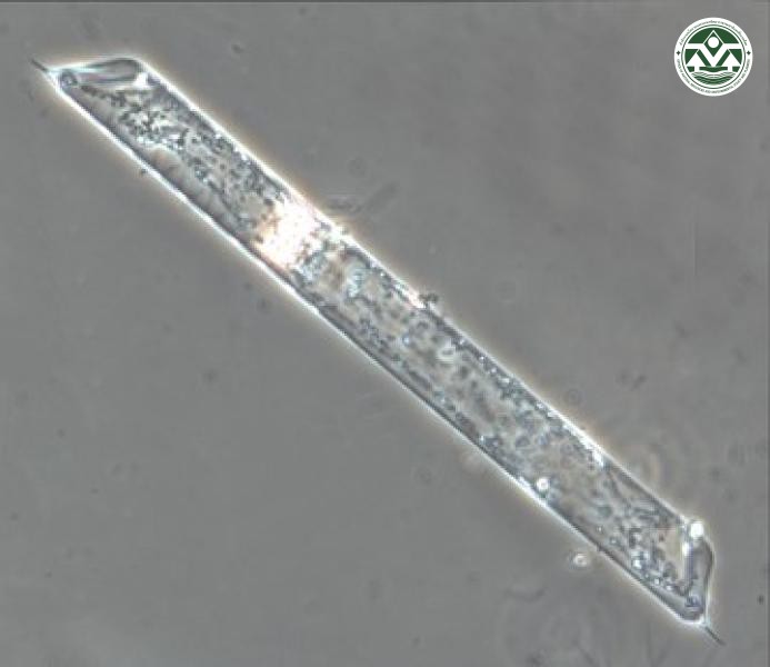 Rhizosolenia imbricata