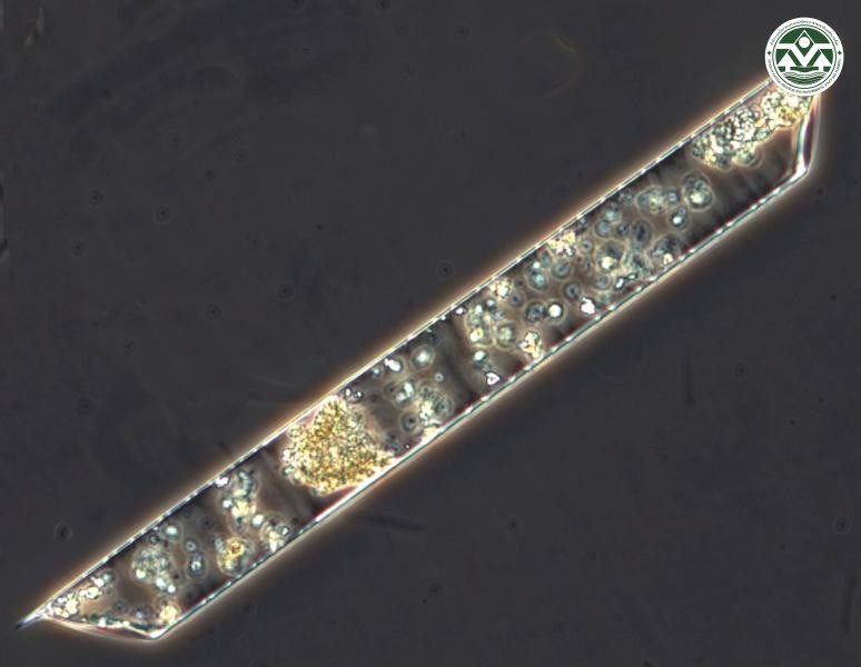 Rhizosolenia striata