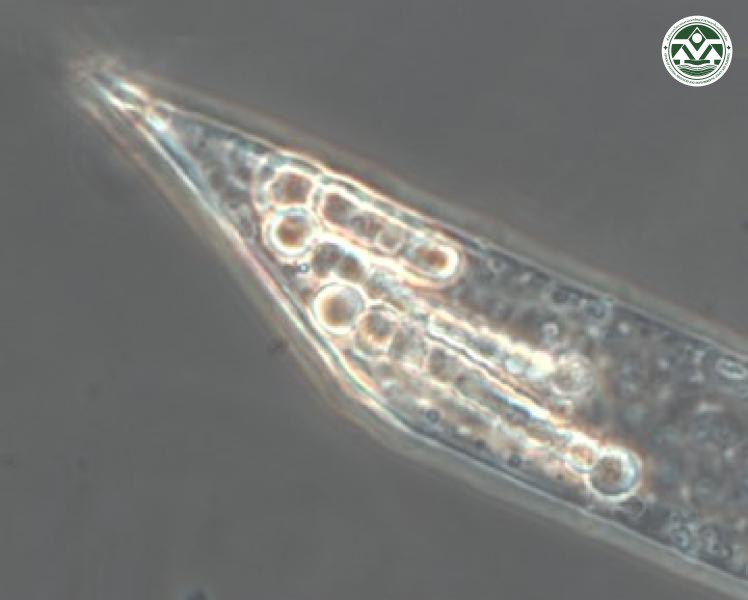 Richelia intracellularis