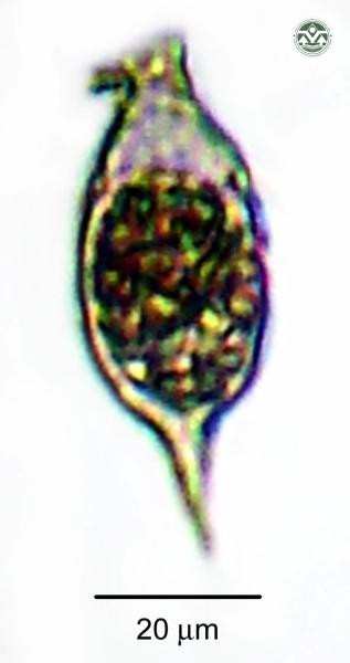 Strombomonas fluviatilis