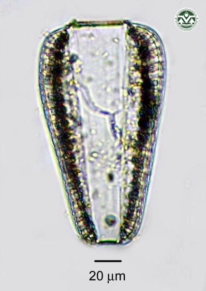 Surirella robusta