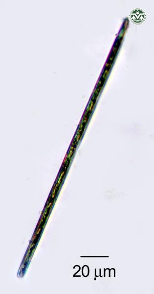 Synedra ulna