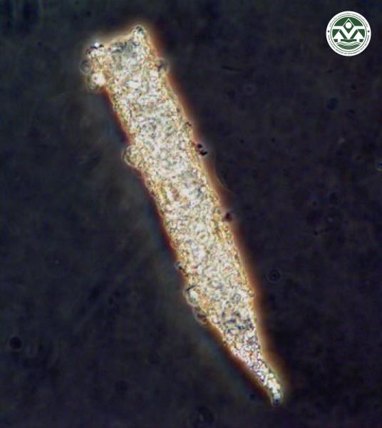 Tintinnopsis radix