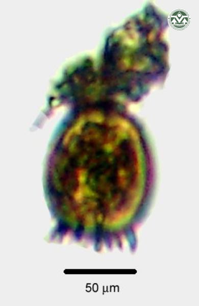 Trachelomonas armata